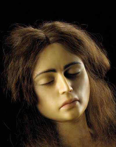 Modelo anatômico de uma gravidez ovariana, detalhe de European School