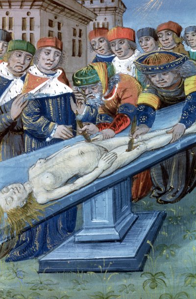 Sra. Hunter 9 f.22r Dissection, de De Medina Fen I. II, por Avicena (980-1037) de Flemish School