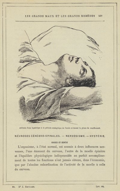 Atitude de um histérico durante o período cataléptico de acesso e durante a fase de crucificação (cor litho) de French School