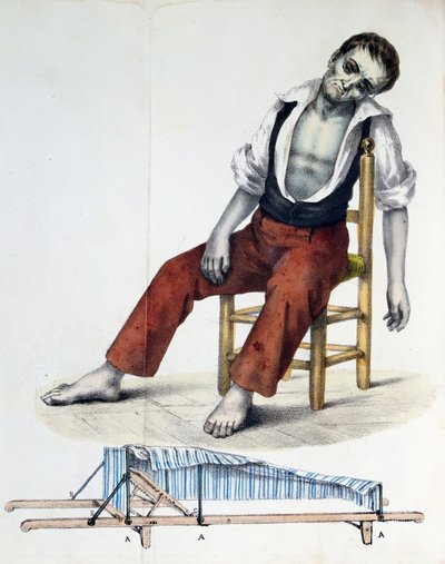 Cholera Morbus, from Relacao, Historica, Statistica e Medica da Cholera-Morbus by Francisco dAssis de Souza Vaz, 1833  de French School
