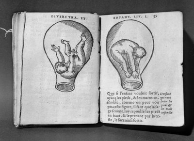 Feto no útero, ilustração do chamado manuscrito de Rodião de French School