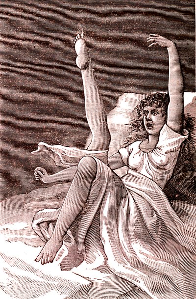 Histeria, um fenómeno extremamente mental, psicoses e psiconeuroses.1887 (gravura) de French School