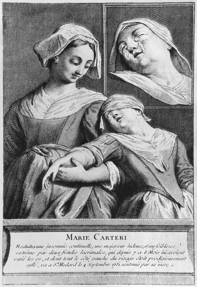 Cura milagrosa de uma mulher cega, Marie Carteri, no túmulo do diácono François de Paris, no cemitério paroquial de Saint-Medard, em Paris de French School