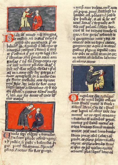 Ms H 89 fol.16v Cirurgia Dentária, de uma edição do &39;Book of Surgery&39; por Rogier de Salerne de French School