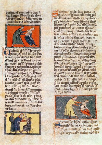 Ms H 89 fol.17r Cirurgia, de uma edição do &39;Livro de Cirurgia&39; por Rogier de Salerne de French School