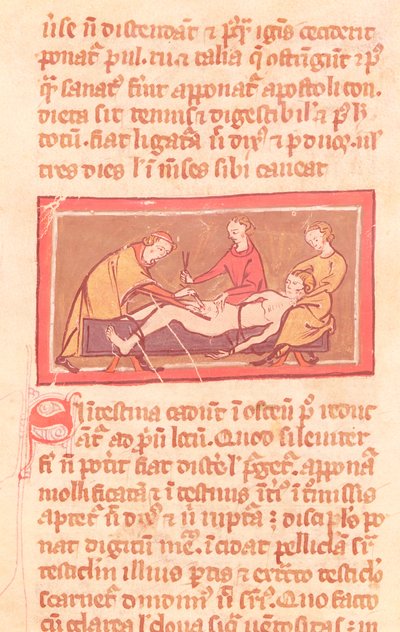 Ms H 89 fol.23 Cirurgia, de uma edição do livro de cirurgia por Rogier de Salerne de French School