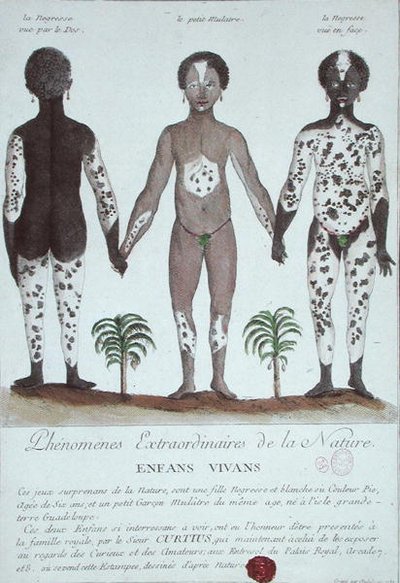 O Fenômeno de Leukoderma de French School