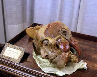 Imagem desconhecida de Gaetano Giulio Zumbo