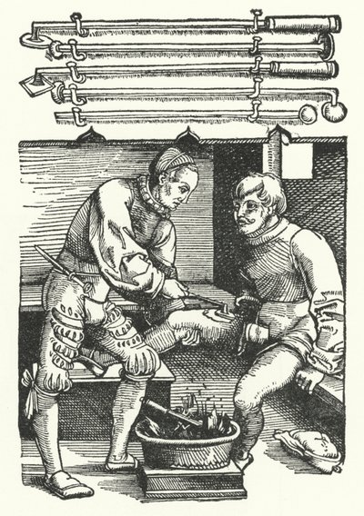Um cirurgião que cauteriza uma ferida na perna de um soldado (gravura) de German School