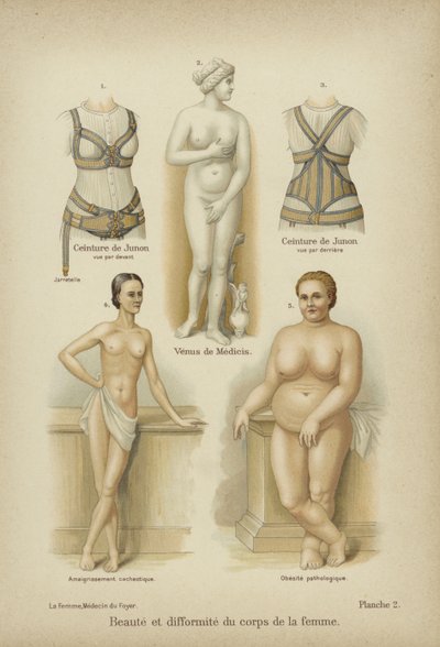 Beleza e misshapennes no corpo feminino de German School