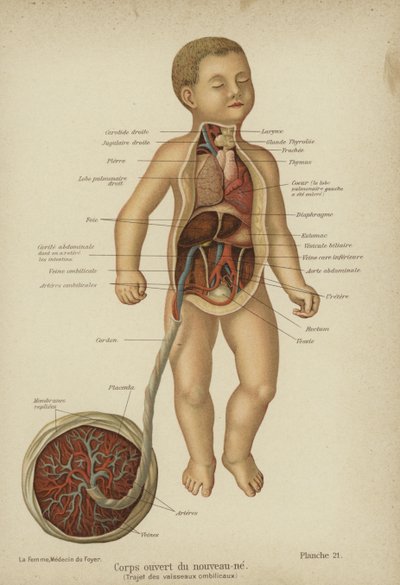 Diagrama de corte mostrando os órgãos internos de um recém-nascido e seu cordão umbilical (cor litho) de German School