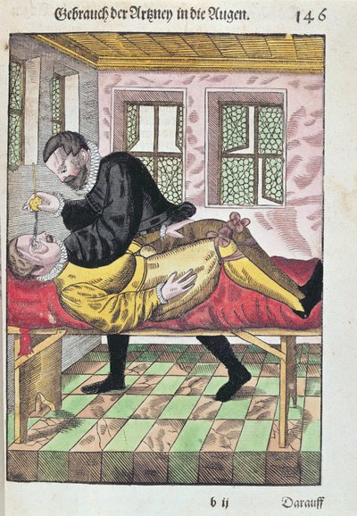Eye Operation, de Ophthalmodouleia por Georg Bartisch (1535-1636), publicado em Dresden em 1583 (impressão em xilogravura a cores) de German School