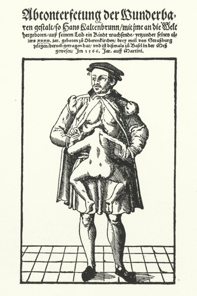 Hans Kaltenbrunn e o seu gémeo conjunto não desenvolvido (gravura) de German School
