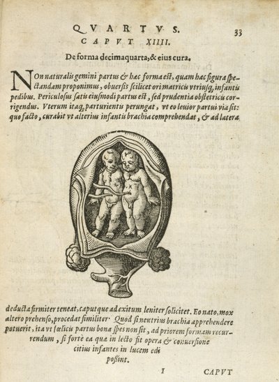 Gêmeos não-idênticos no útero, ilustração do capítulo 14, livro 4 de Na concepção e crescimento do homem, de Rueff, 1587 de German School