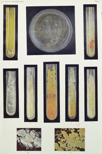 Syphilus Bacillus, de um livro de Max von Niessen, Leipzig, 1908 de German School