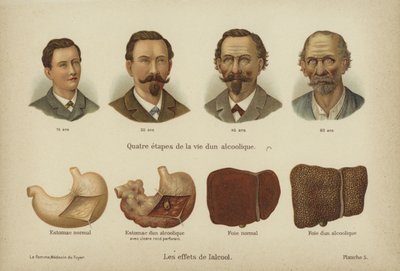 Os efeitos do abuso do álcool (cor litho) de German School