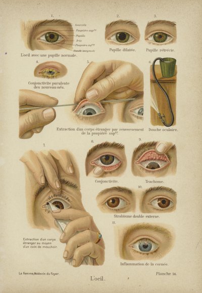 O olho (cor litho) de German School
