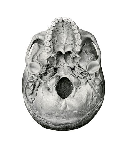 Visão Ventral do Crânio Humano de German School