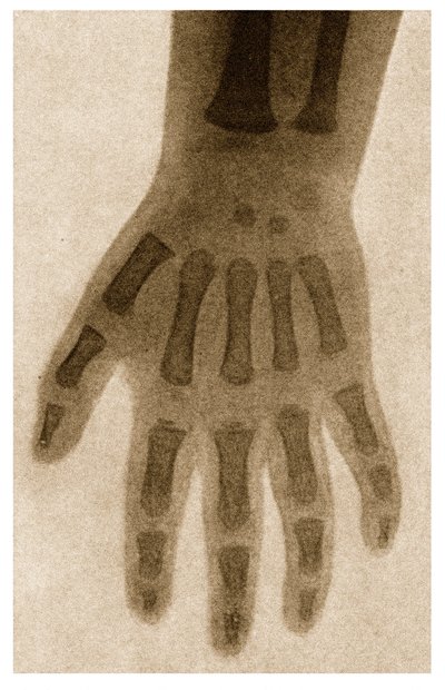 Raio X de uma mão de criança c.1890 de German School