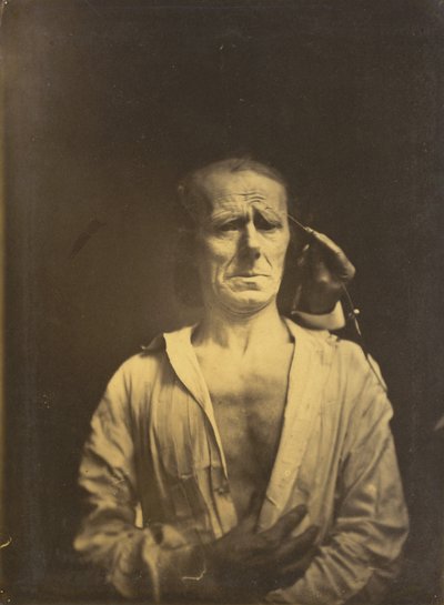 Espasmo de m. corrugator supercilii sob luz muito forte (esquerda); Um rosto relaxado (fotografado em pleno sol) (à direita) de Guillaume Benjamin Amant Duchenne