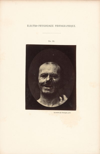 Eletrofisiologia fotográfica, Figura 53 de Guillaume Benjamin Duchenne