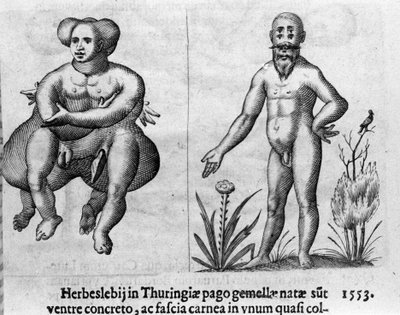 Diferentes tipos de monstros humanos. Gravura de "De monstrorum natura, causis et differentiis" de Fortunio Liceti (1577-1656), cientista italiano. 1646 de Italian School