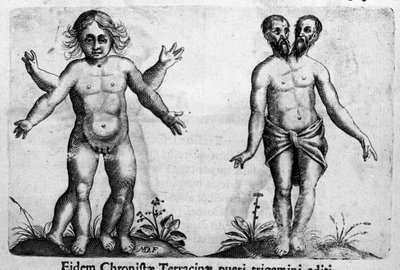 Diferentes tipos de monstros humanos gravados de "De monstrorum natura, causis et differentiis" de Fortunio Liceti (1577-1656), cientista italiano. 1646 de Italian School