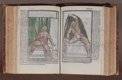 anatomia feminina, de História, com as mais generosas adições ao mundini anatomia, byJacopo Berengarlo da Carpi (c.1460-c.1530), publicado em Bolonha, (impressão cor woodblock) 1521 de Italian School