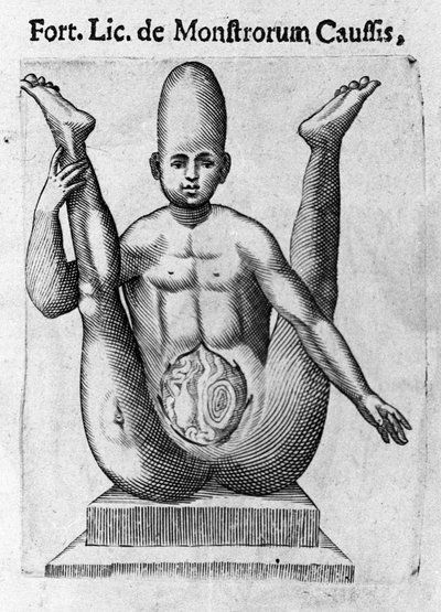 Monstro humano: uma criatura com um crânio enorme, com intestinos aparentes. Gravura de "De monstrorum natura, causis et differentiis" de Fortunio Liceti (1577-1656), cientista italiano. 1646 de Italian School