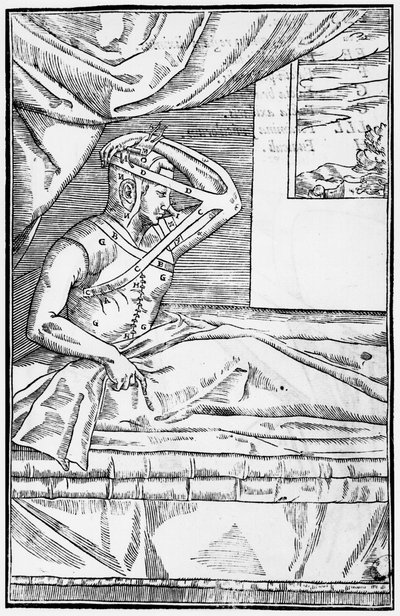 Cirurgia reconstrutiva no nariz, ilustração de De curtorum chirurgia per insitionem por Gaspare Tagliacozzi (1545-99) Veneza, publicado em 1597 de Italian School