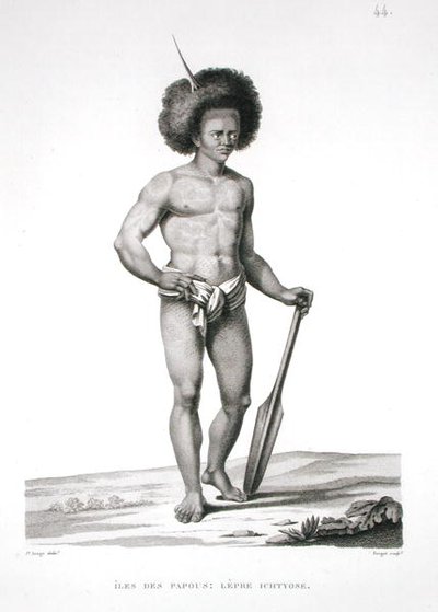 Ilhas Papua: Leprosy Victim, de 