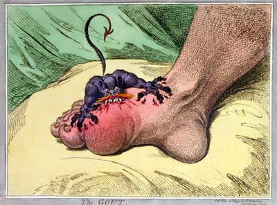 The Gout, publicado por Hannah Humphrey em 1799 (gravura de softdground colorido à mão) de James Gillray