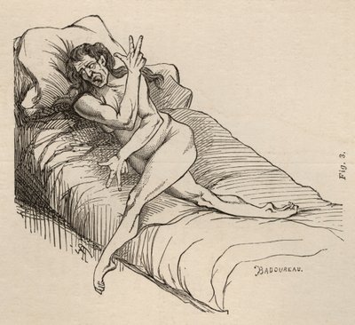 Epilepsia histérica, ataque, contorções, figo. 3 de &39;Iconografia fotográfica de La Salpetriere&39; de Bourneville e P. Regnard, Paris, 1876 de Jean Francois Badoureau