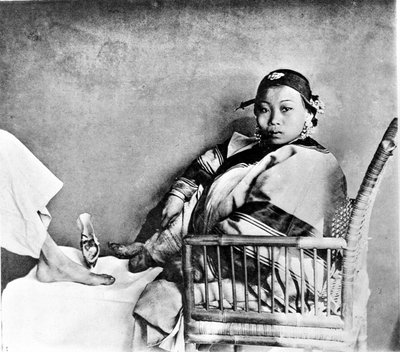 Mulher mostrando seu pé mutilado usando sapatos tradicionais ao lado de um pé europeu (foto) de John Thomson