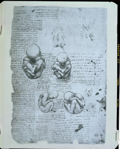 Cinco visões de um feto no útero, cópia fac-símile de Leonardo da Vinci