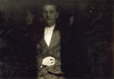 Frank Wiegel, de Brooklyn, ferido depois de ter trabalhado 18 horas por dia aos 15 anos de idade, tendo-lhe sido amputados dois dedos da mão direita, na cidade de Nova Iorque de Lewis Wickes Hine