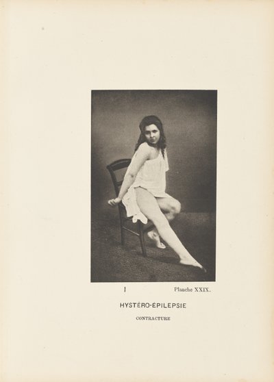 Contractura histero-epilética de Paul Marie Léon Regnard