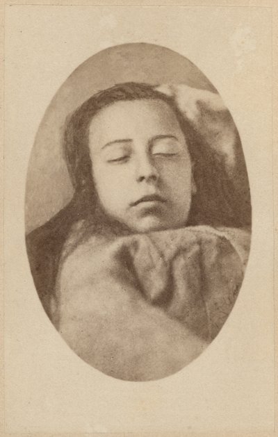 Ataque da histeria, segunda fase, ilustração da &39;Iconografia Fotográfica de La Salpetriere&39; de Bourneville et P. Regnard, placa III, Paris, 1876 (impressão albumen) de Paul Regnard