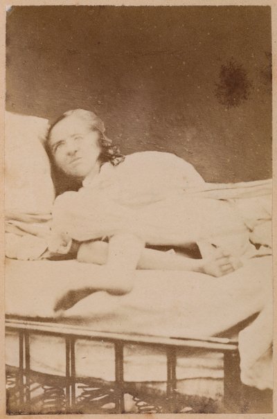 Epilepsia histérica, contorções, placa XXXVIII de &39;Iconografia fotográfica de La Salpetriere&39; por Bourneville e P. Regnard, Paris, 1876 (albumen print) de Paul Regnard