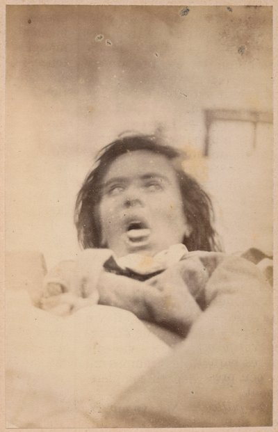 Epilepsia histérica, alucinações, angústia, plano XXIX da &39;Iconografia fotográfica de La Salpetriere&39; de Bourneville e P. Regnard, Paris, 1876 (impressão de albume) de Paul Regnard