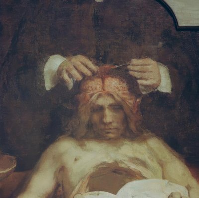 A anatomia do Dr. Ing. Johan Deijman de Rembrandt van Rijn