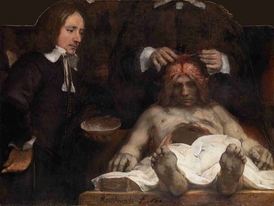 A lição de anatomia do Dr. Jan Deijman, 1656 de Rembrandt van Rijn