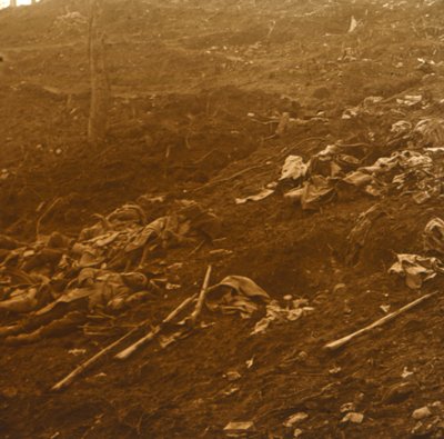 Após o ataque, Les Éparges, norte da França, 1915. de Unbekannt