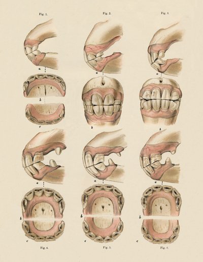 Descrição da placa mostrando a idade, conforme indicado pelos dentes, c1879. de Unbekannt