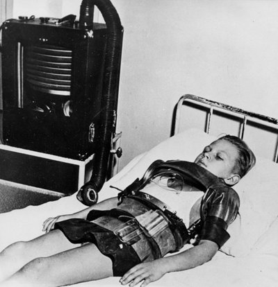 Menino de onze anos de idade em um pulmão de ferro, Hospital Beaujon, Paris, c1947-1951 de Unbekannt