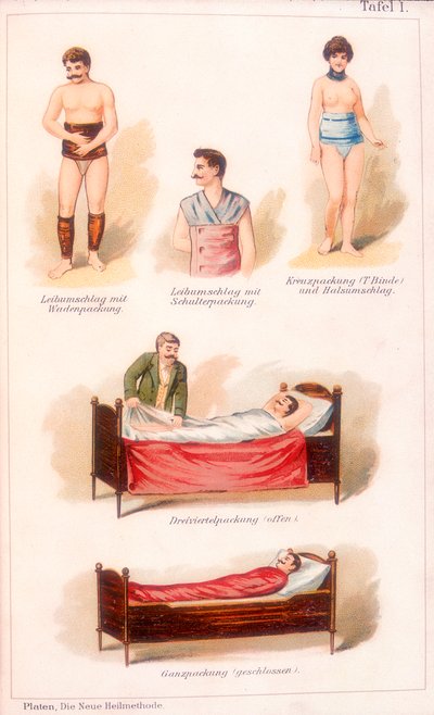 Tratamentos de hidroterapia, c1902 de Unbekannt