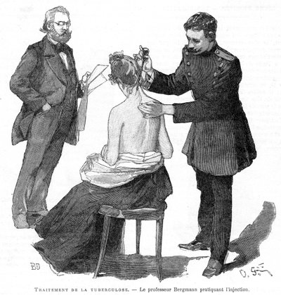 Professor Bergmann injetando um paciente de tuberculose, 1891 de Unbekannt