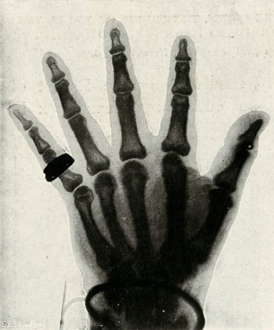 Radiografia da mão de HRH O Príncipe de Gales, c1897 de Unbekannt