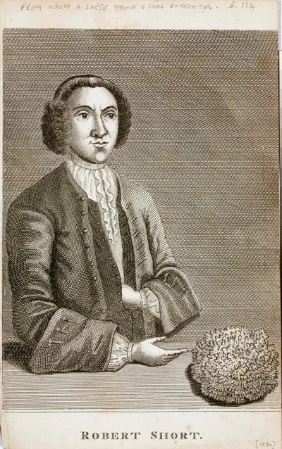 Robert Short, curiosidade médica, c 1750s de Unbekannt