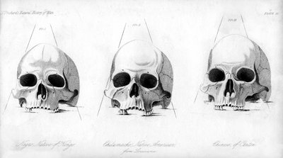 Três tipos de crânio humano, 1848 de Unbekannt